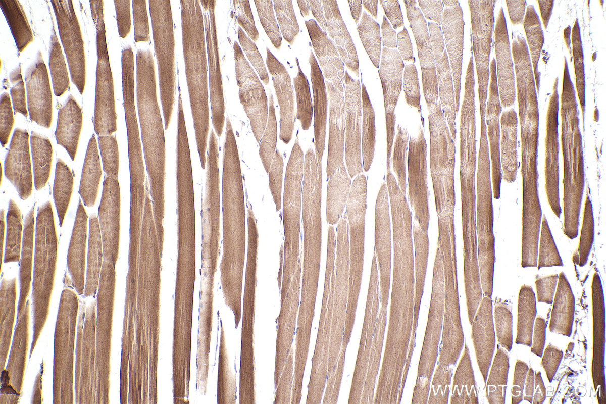 Immunohistochemical analysis of paraffin-embedded mouse skeletal muscle tissue slide using KHC2535 (KLHL22 IHC Kit).