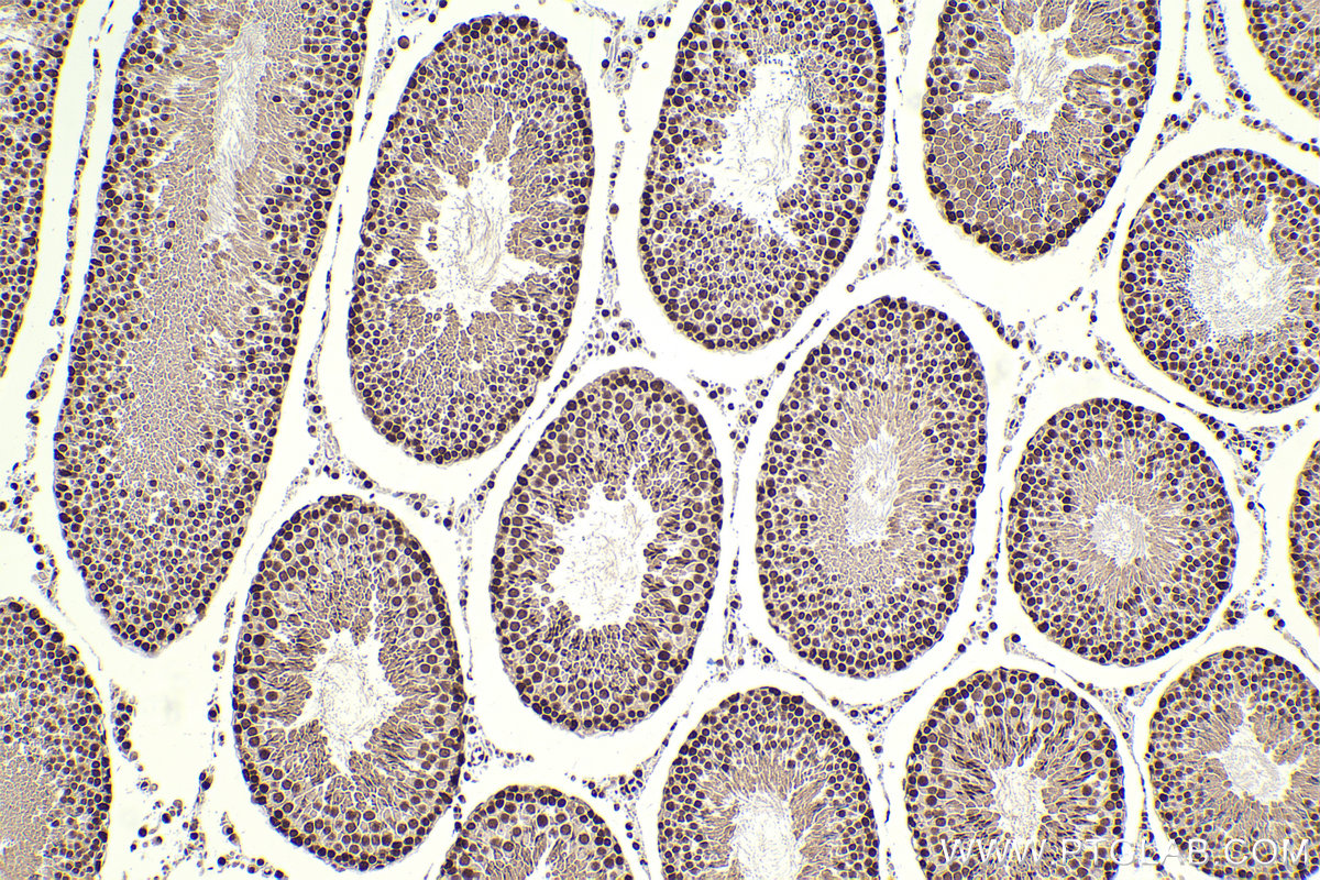 Immunohistochemical analysis of paraffin-embedded rat testis tissue slide using KHC2310 (KPNA1 IHC Kit).