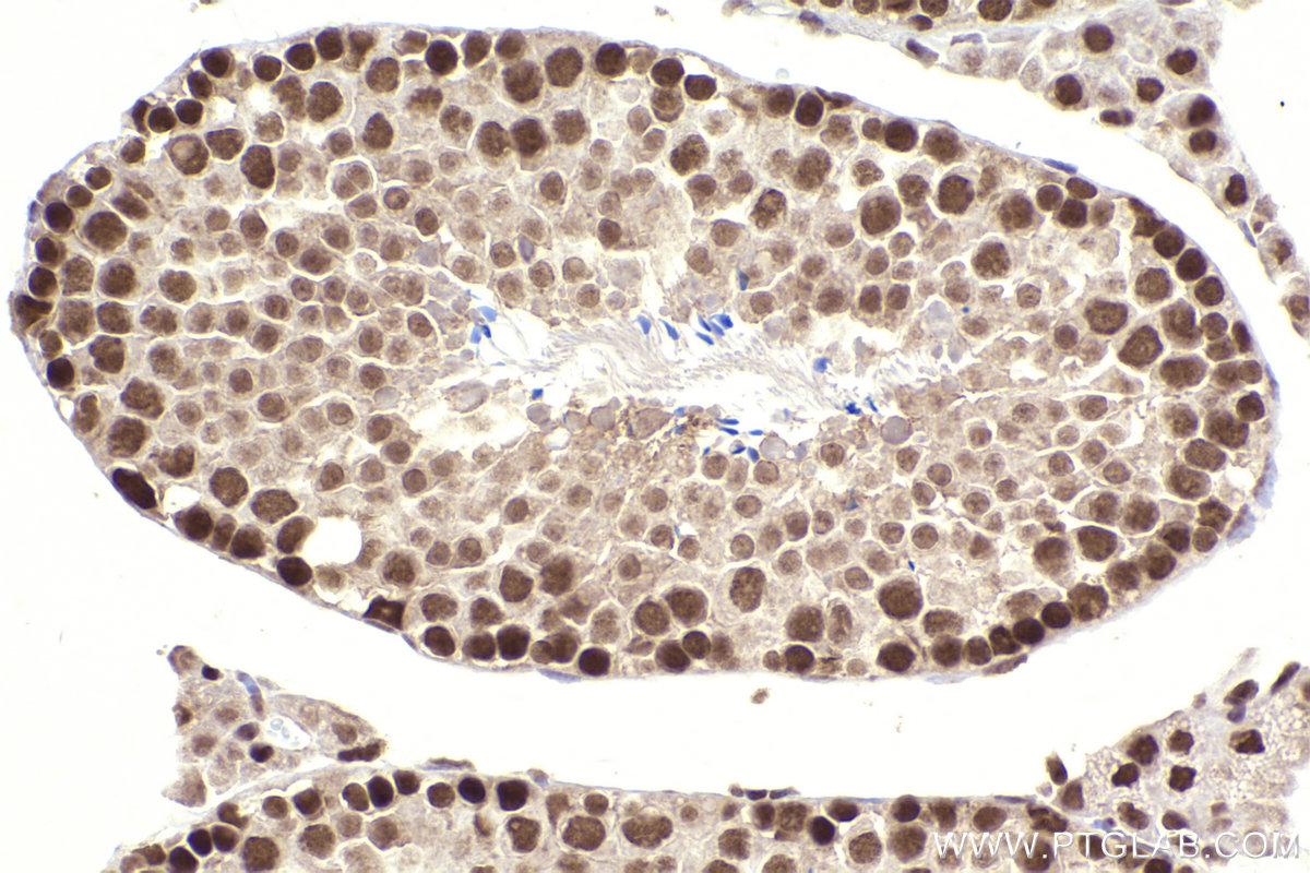 Immunohistochemical analysis of paraffin-embedded mouse testis tissue slide using KHC2310 (KPNA1 IHC Kit).