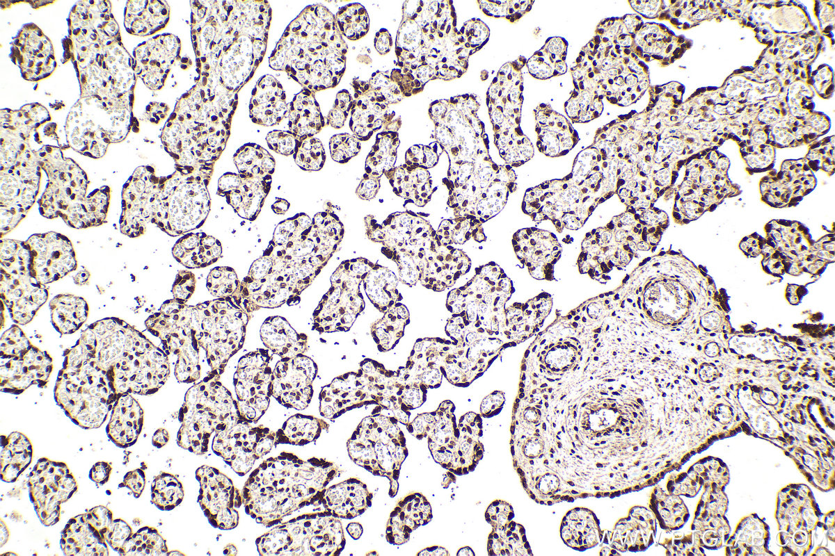 Immunohistochemical analysis of paraffin-embedded human placenta tissue slide using KHC2102 (KPNA6 IHC Kit).