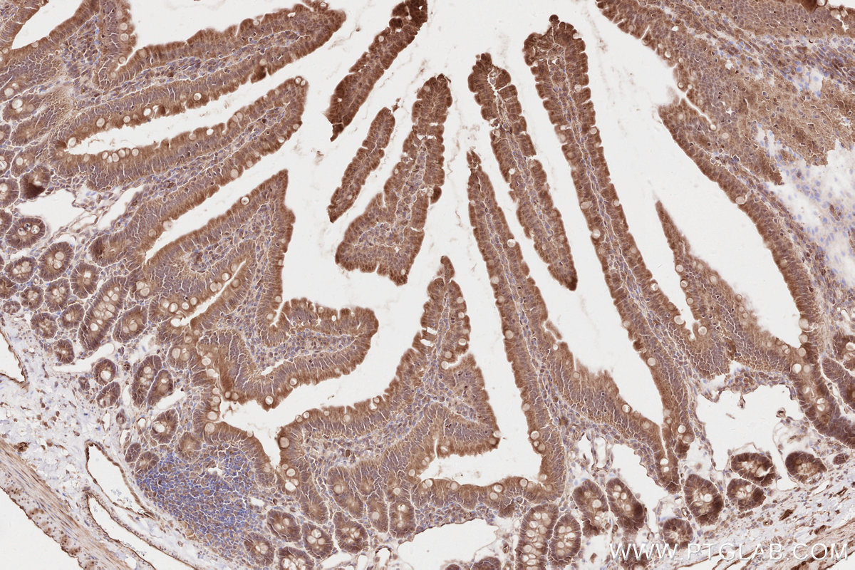 Immunohistochemical analysis of paraffin-embedded rat small intestine tissue slide using KHC2635 (KTN1 IHC Kit).