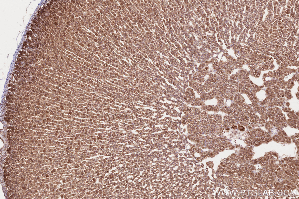 Immunohistochemical analysis of paraffin-embedded rat adrenal gland tissue slide using KHC2635 (KTN1 IHC Kit).