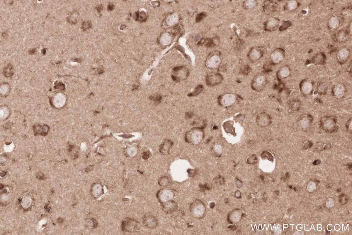 Immunohistochemical analysis of paraffin-embedded mouse brain tissue slide using KHC2635 (KTN1 IHC Kit).