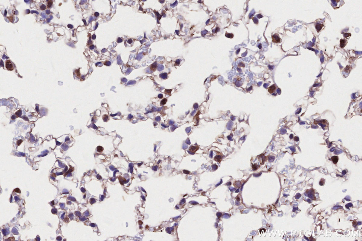Immunohistochemical analysis of paraffin-embedded mouse lung tissue slide using KHC2644 (LACC1 IHC Kit).