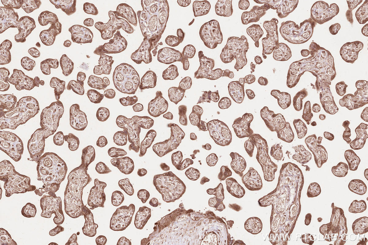 Immunohistochemical analysis of paraffin-embedded human placenta tissue slide using KHC2609 (LARP4 IHC Kit).