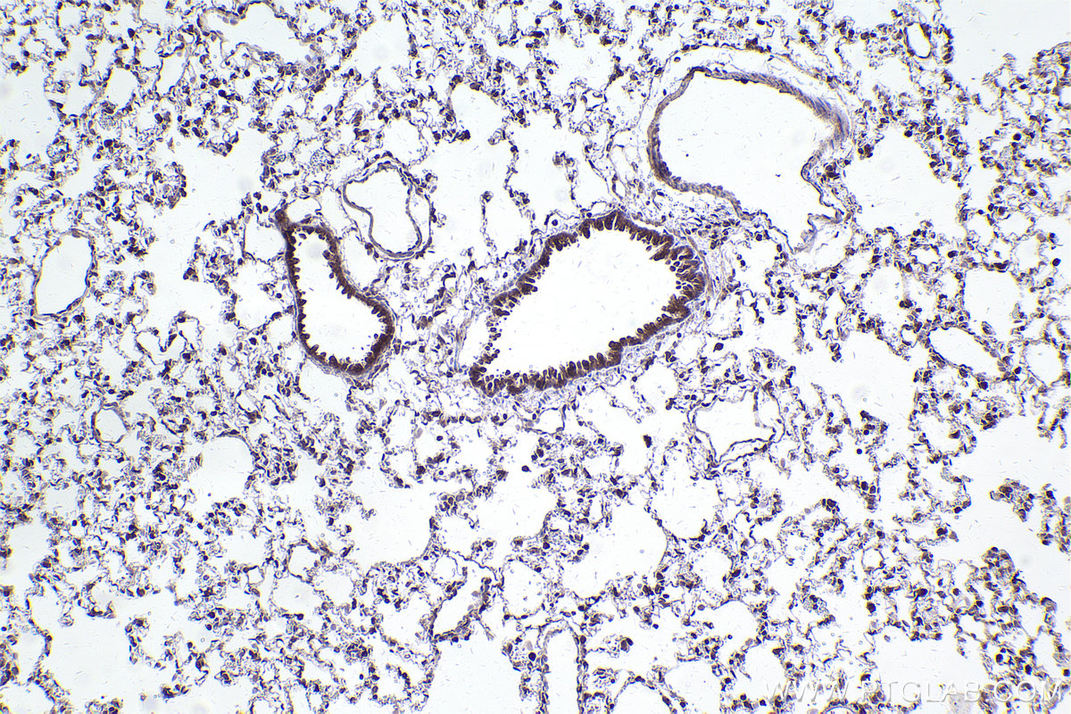 Immunohistochemical analysis of paraffin-embedded rat lung tissue slide using KHC2467 (LBR IHC Kit).