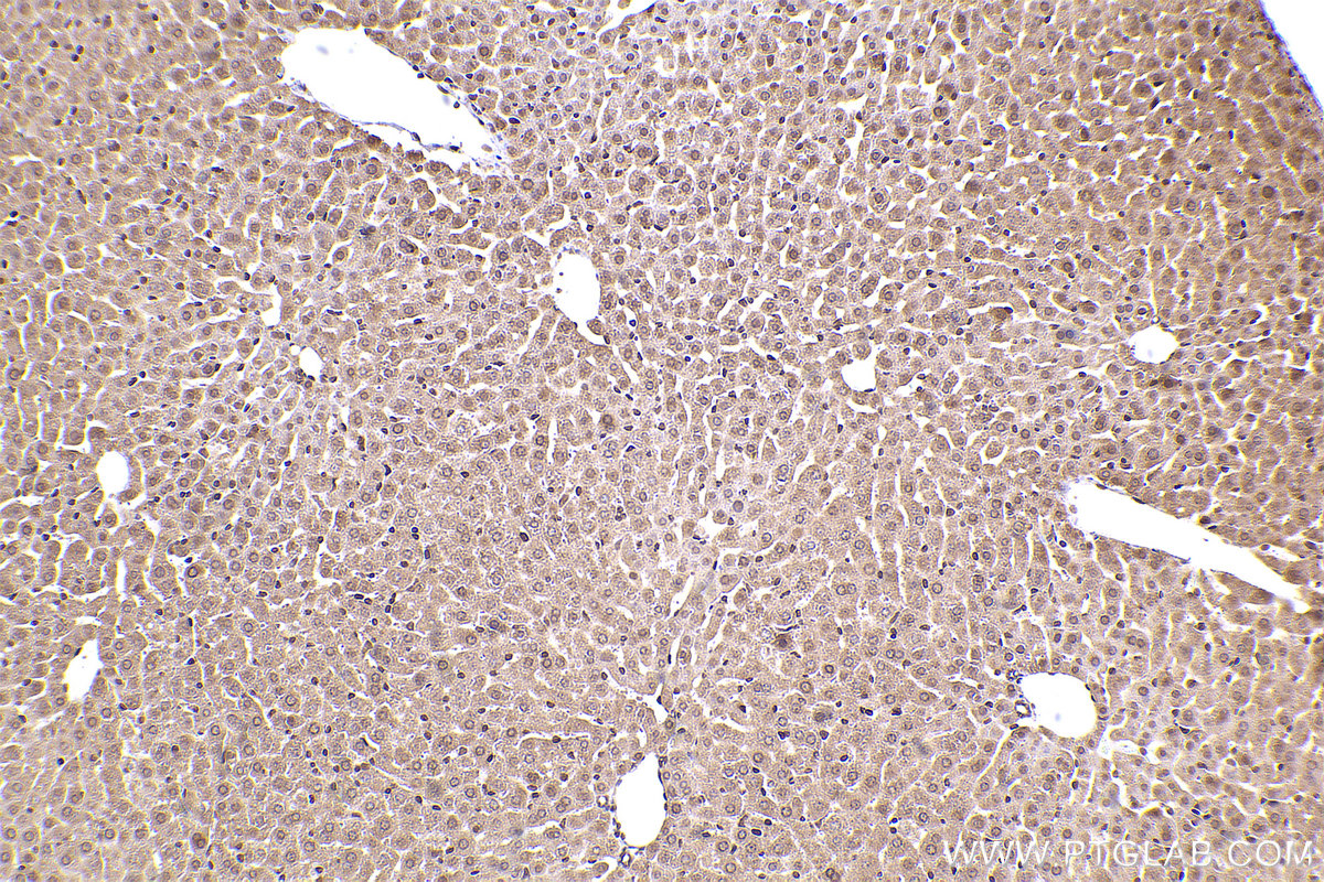 Immunohistochemical analysis of paraffin-embedded mouse liver tissue slide using KHC2467 (LBR IHC Kit).