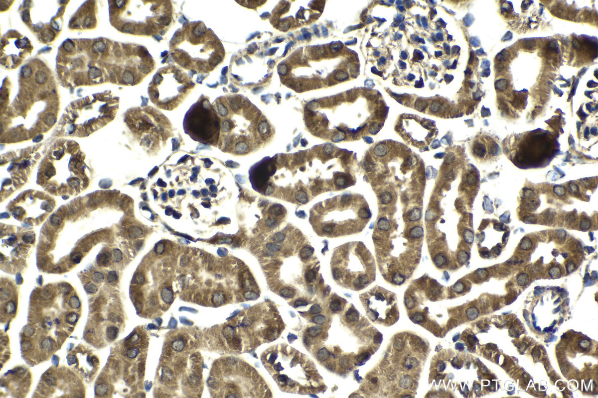 Immunohistochemical analysis of paraffin-embedded mouse kidney tissue slide using KHC2135 (LETM1 IHC Kit).
