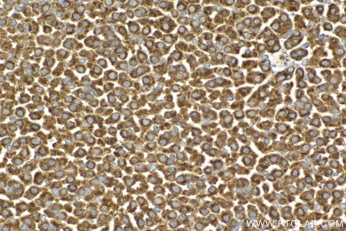 Immunohistochemical analysis of paraffin-embedded mouse adrenal gland tissue slide using KHC2135 (LETM1 IHC Kit).