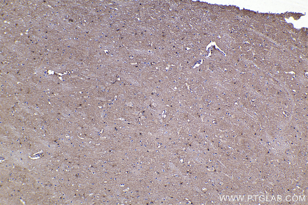 Immunohistochemical analysis of paraffin-embedded human hypothalamus tissue slide using KHC2317 (LIMK1 IHC Kit).