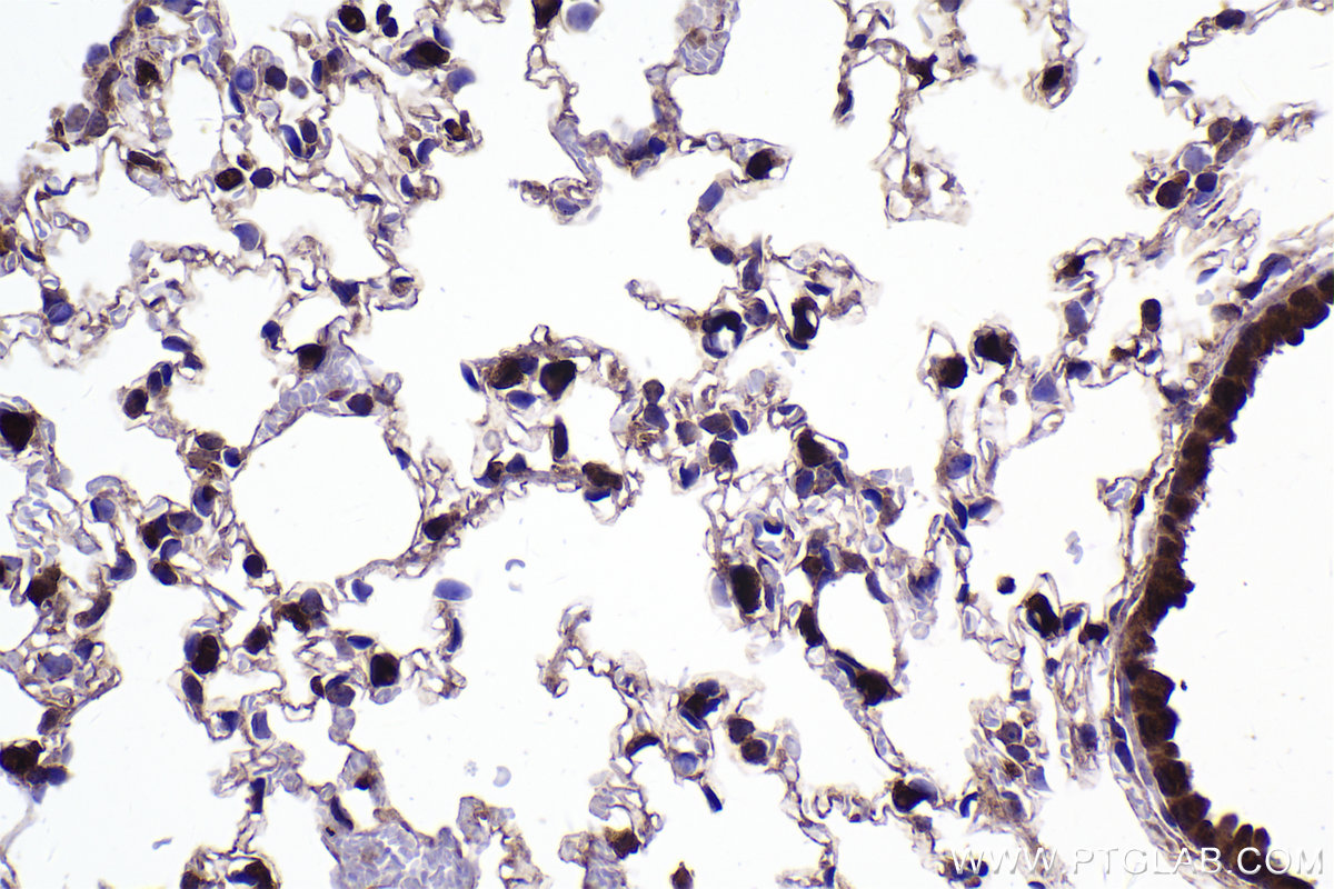 Immunohistochemical analysis of paraffin-embedded mouse lung tissue slide using KHC2317 (LIMK1 IHC Kit).