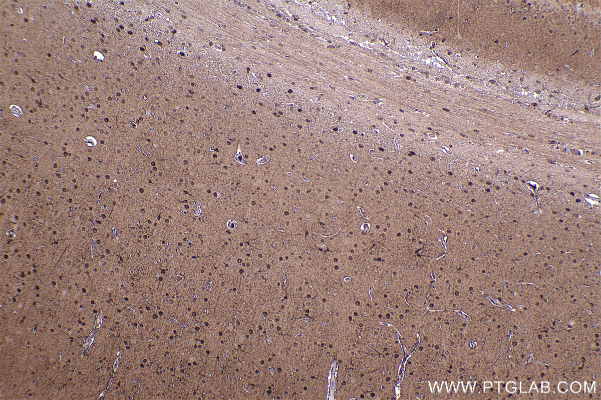 Immunohistochemical analysis of paraffin-embedded rat brain tissue slide using KHC2317 (LIMK1 IHC Kit).