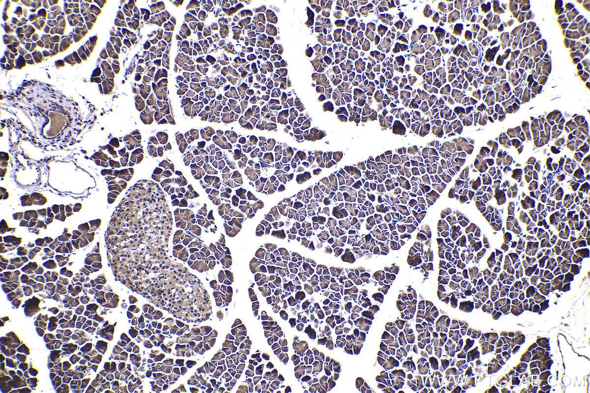 Immunohistochemical analysis of paraffin-embedded mouse pancreas tissue slide using KHC2318 (LIMK2 IHC Kit).