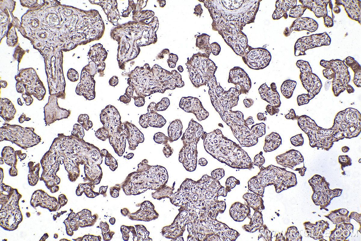 Immunohistochemical analysis of paraffin-embedded human placenta tissue slide using KHC2272 (LIS1 IHC Kit).