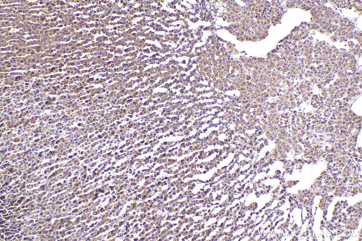 Immunohistochemical analysis of paraffin-embedded rat adrenal gland tissue slide using KHC2287 (LMAN1 IHC Kit).