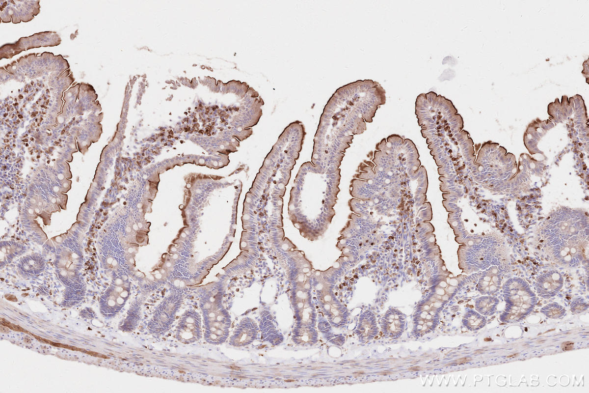 Immunohistochemical analysis of paraffin-embedded rat small intestine tissue slide using KHC2615 (LPCAT2 IHC Kit).