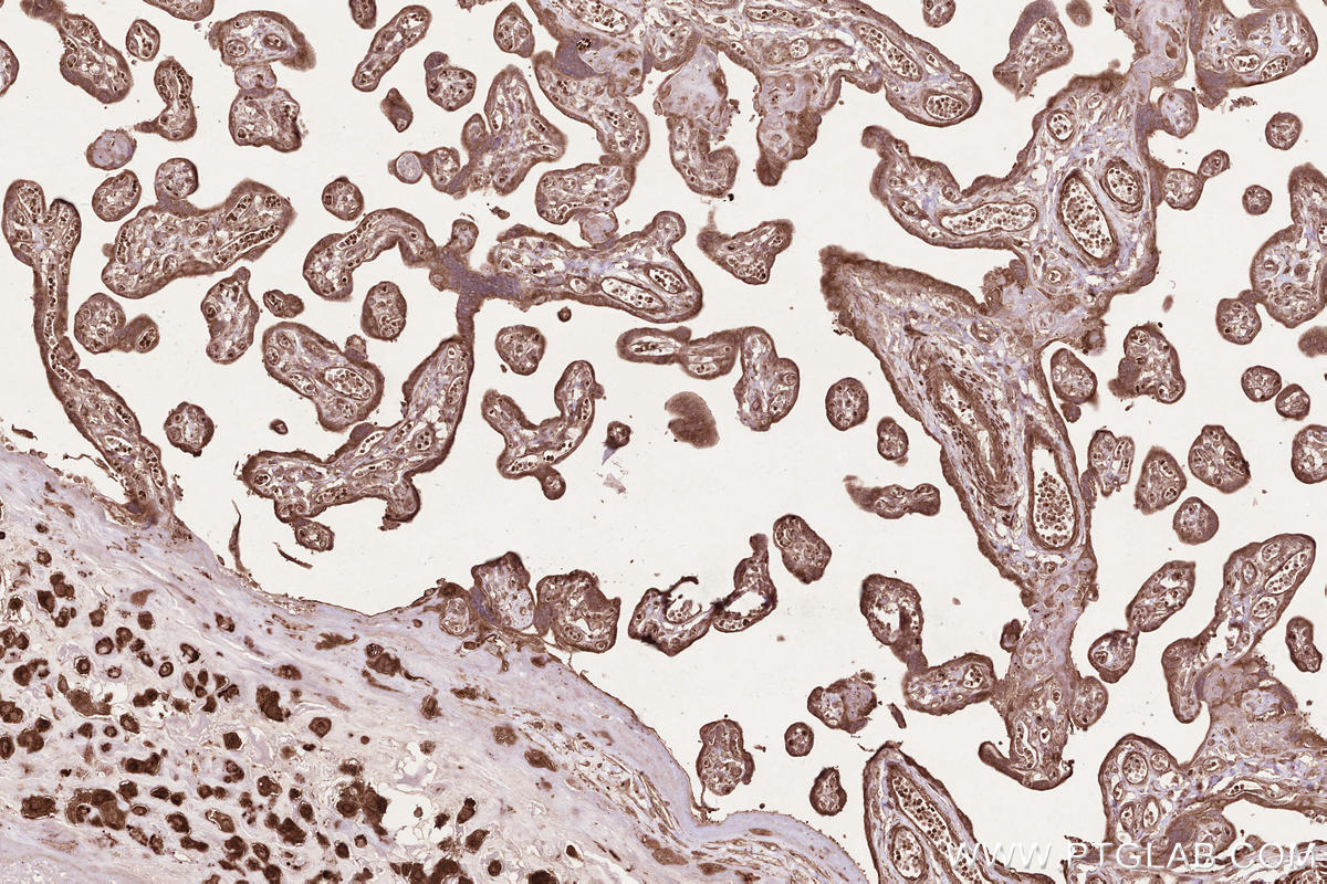 Immunohistochemical analysis of paraffin-embedded human placenta tissue slide using KHC2570 (LPCAT4 IHC Kit).