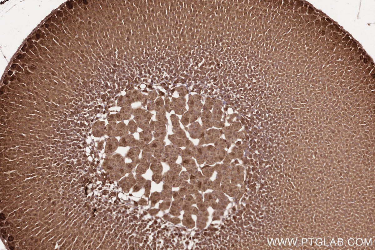 Immunohistochemical analysis of paraffin-embedded mouse adrenal gland tissue slide using KHC2570 (LPCAT4 IHC Kit).