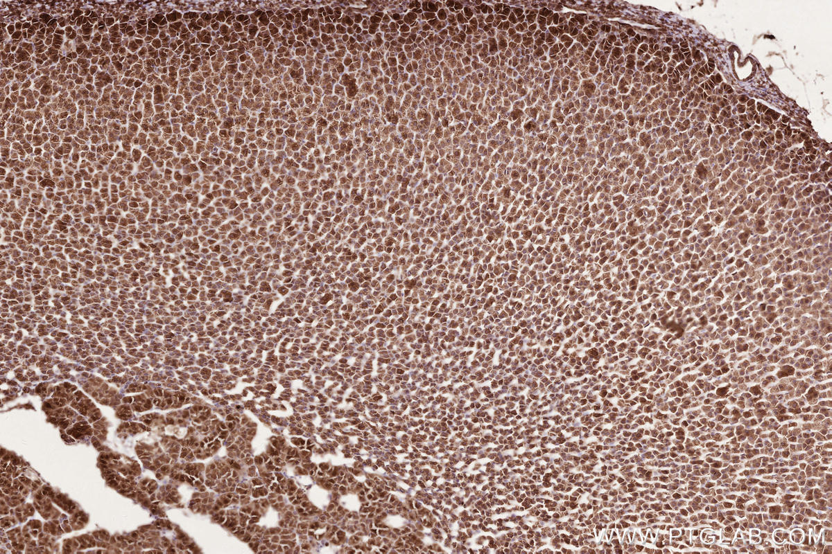 Immunohistochemical analysis of paraffin-embedded rat adrenal gland tissue slide using KHC2570 (LPCAT4 IHC Kit).