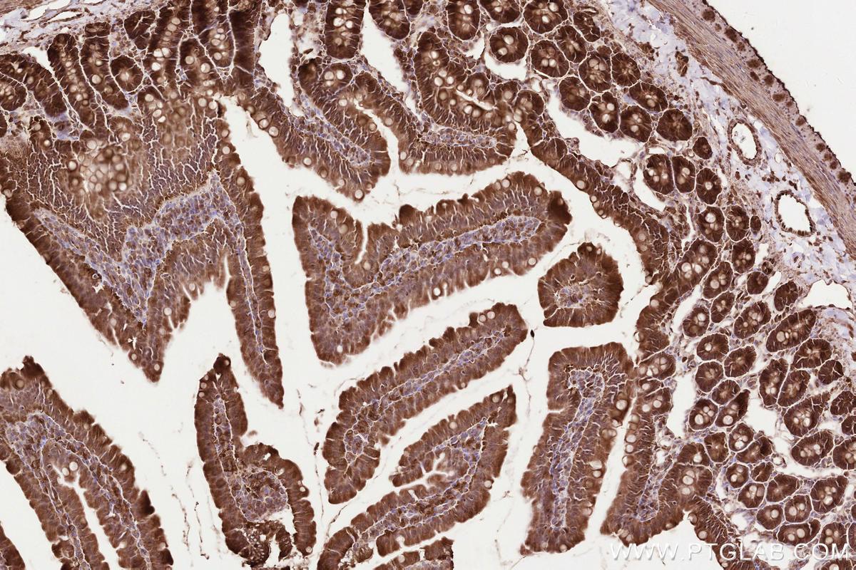 Immunohistochemical analysis of paraffin-embedded rat small intestine tissue slide using KHC2570 (LPCAT4 IHC Kit).