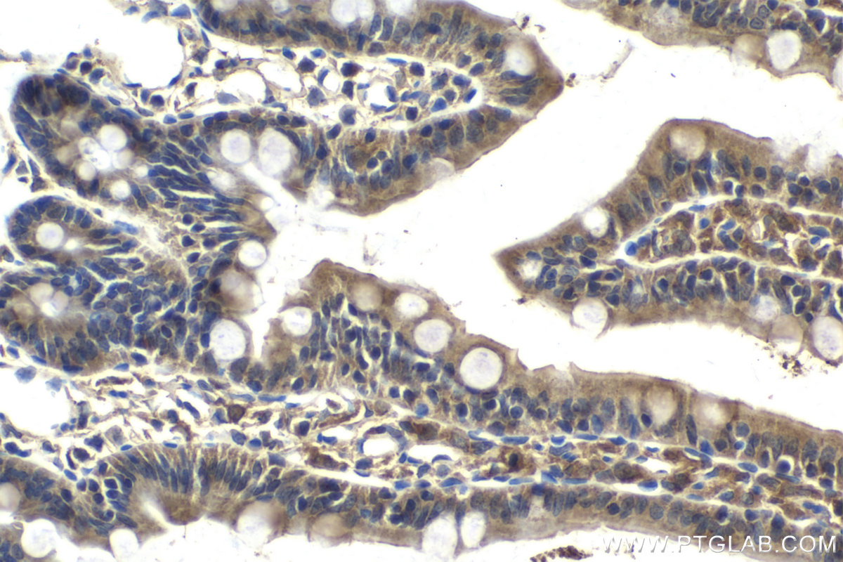 Immunohistochemical analysis of paraffin-embedded rat small intestine tissue slide using KHC2141 (LRAT IHC Kit).