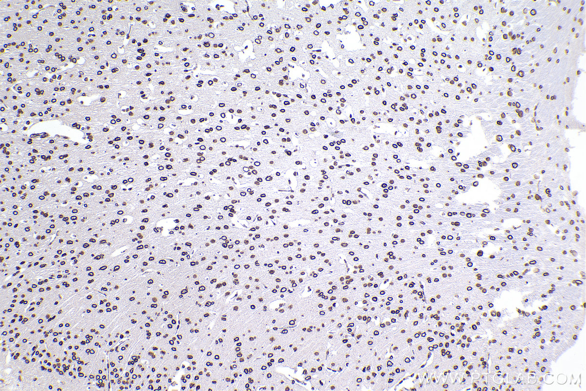 Immunohistochemical analysis of paraffin-embedded mouse brain tissue slide using KHC2389 (Lamin B2 IHC Kit).