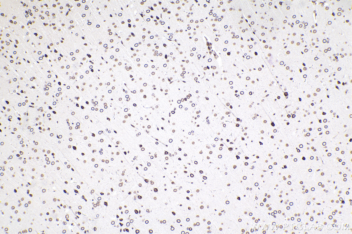 Immunohistochemical analysis of paraffin-embedded rat brain tissue slide using KHC2389 (Lamin B2 IHC Kit).