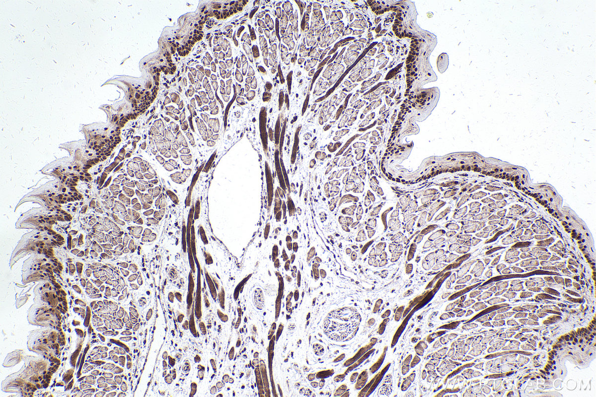 Immunohistochemical analysis of paraffin-embedded mouse tongue tissue slide using KHC2476 (MAD2L1BP IHC Kit).