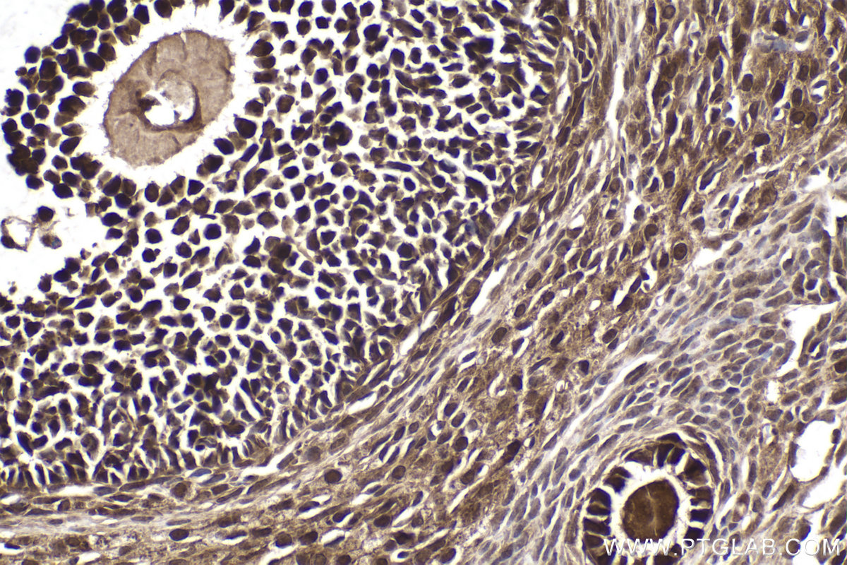 Immunohistochemical analysis of paraffin-embedded rat ovary tissue slide using KHC2029 (MAGED1 IHC Kit).