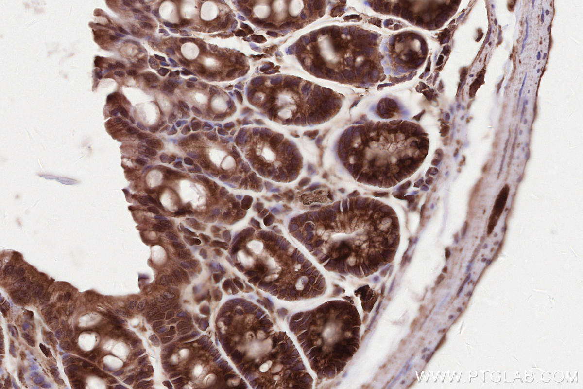 Immunohistochemical analysis of paraffin-embedded mouse colon tissue slide using KHC2571 (MAP1S IHC Kit).