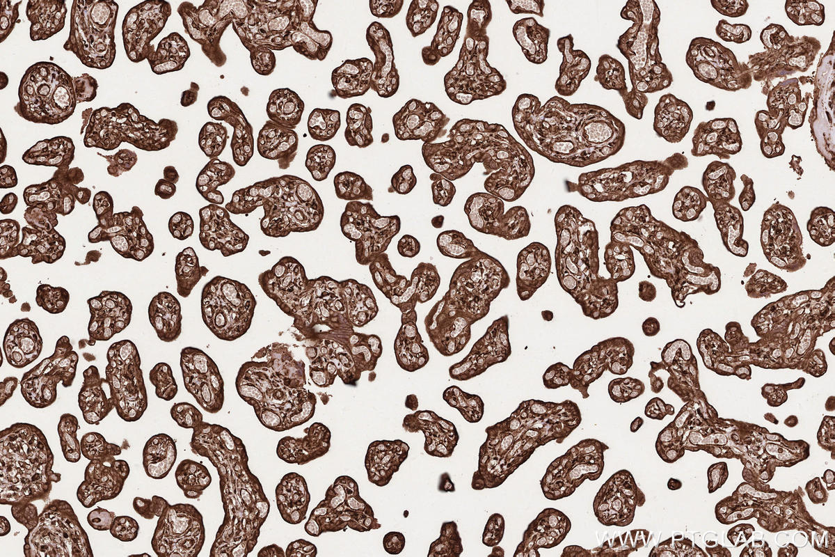 Immunohistochemical analysis of paraffin-embedded human placenta tissue slide using KHC2571 (MAP1S IHC Kit).