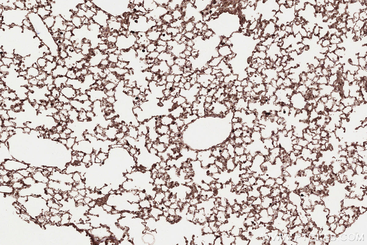 Immunohistochemical analysis of paraffin-embedded mouse lung tissue slide using KHC2571 (MAP1S IHC Kit).