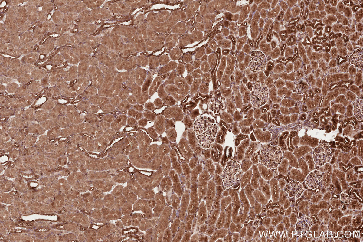 Immunohistochemical analysis of paraffin-embedded rat kidney tissue slide using KHC2571 (MAP1S IHC Kit).