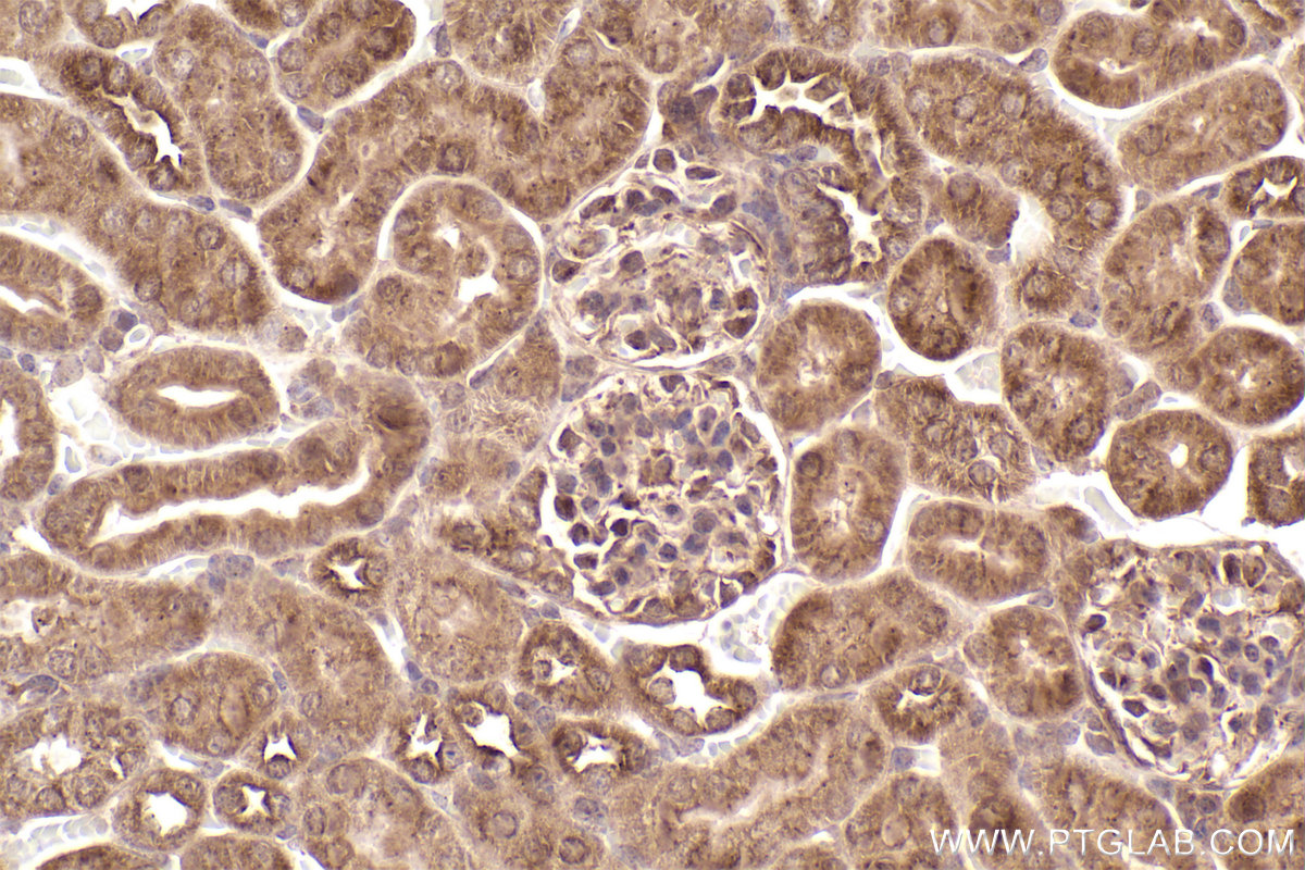 Immunohistochemical analysis of paraffin-embedded mouse kidney tissue slide using KHC2531 (MAP9 IHC Kit).