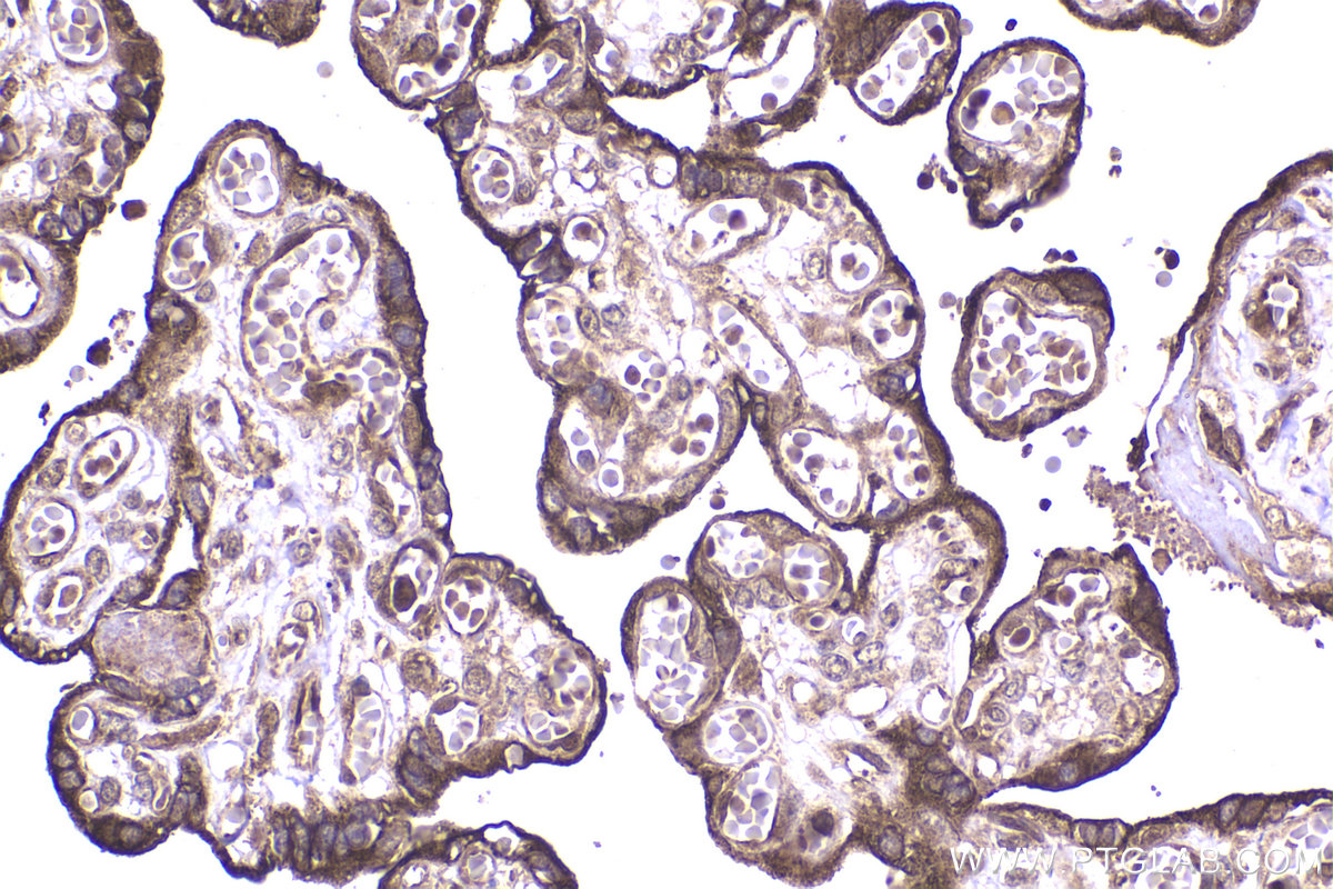 Immunohistochemical analysis of paraffin-embedded human placenta tissue slide using KHC2320 (MAPK12 IHC Kit).