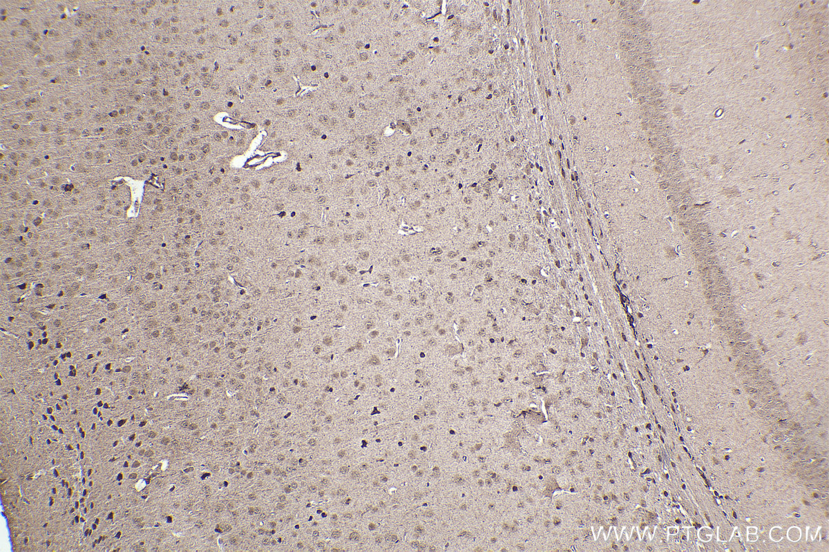 Immunohistochemical analysis of paraffin-embedded mouse brain tissue slide using KHC2232 (MAPK4 IHC Kit).