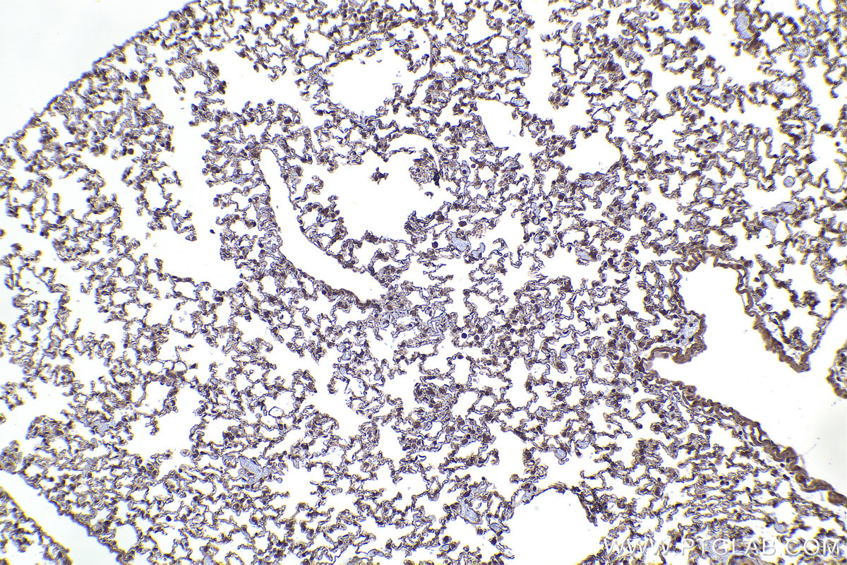 Immunohistochemical analysis of paraffin-embedded mouse lung tissue slide using KHC2267 (MAPK8/JNK IHC Kit).