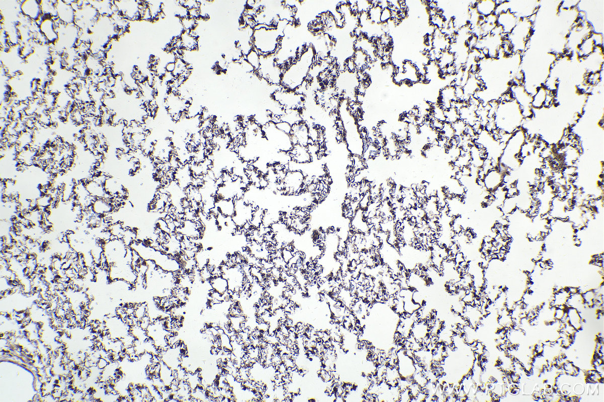 Immunohistochemical analysis of paraffin-embedded rat lung tissue slide using KHC2267 (MAPK8/JNK IHC Kit).