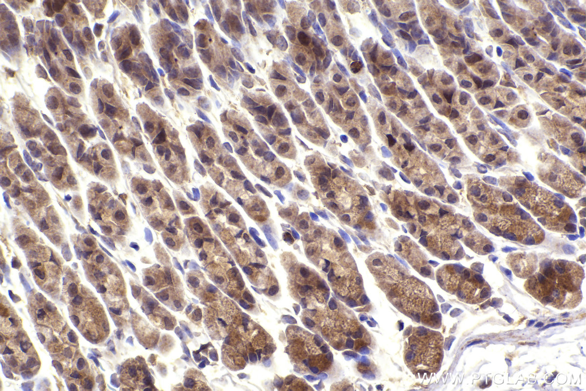 Immunohistochemical analysis of paraffin-embedded mouse stomach tissue slide using KHC2347 (MAPKAPK2 IHC Kit).