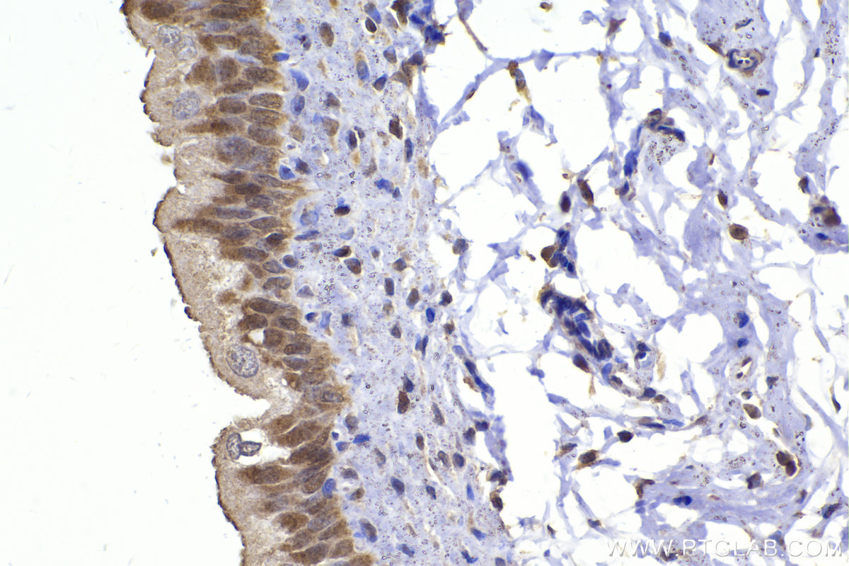 Immunohistochemical analysis of paraffin-embedded rat bladder tissue slide using KHC2347 (MAPKAPK2 IHC Kit).