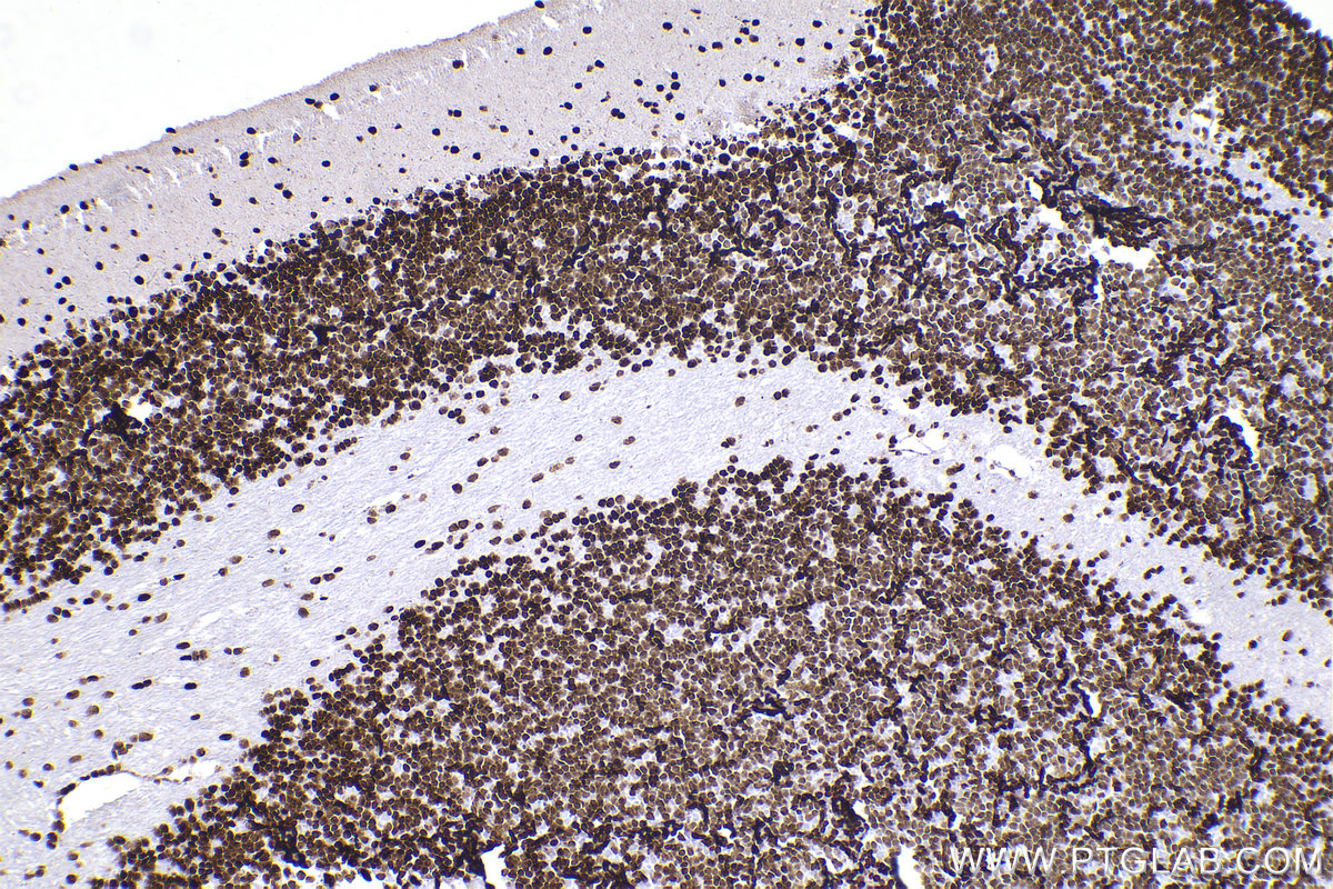 Immunohistochemical analysis of paraffin-embedded mouse cerebellum tissue slide using KHC2263 (MATR3 IHC Kit).