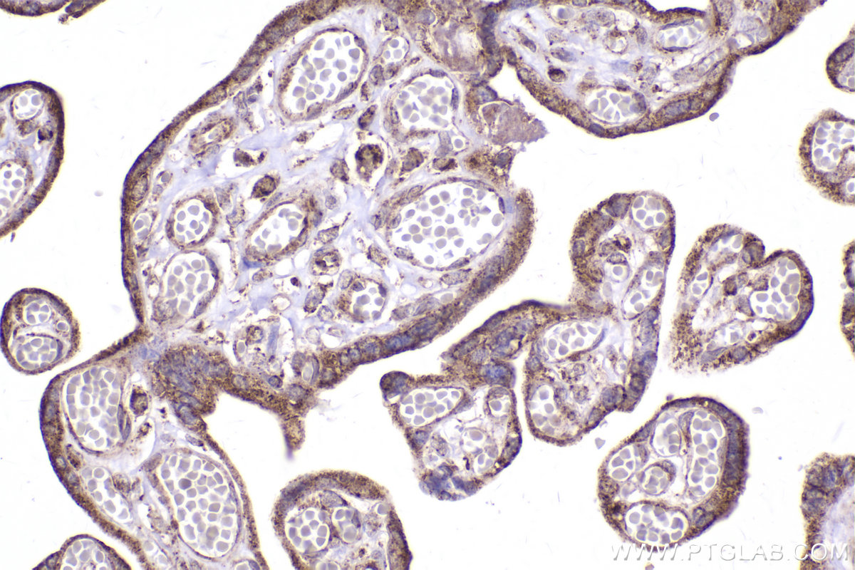 Immunohistochemical analysis of paraffin-embedded human placenta tissue slide using KHC2464 (MELK IHC Kit).