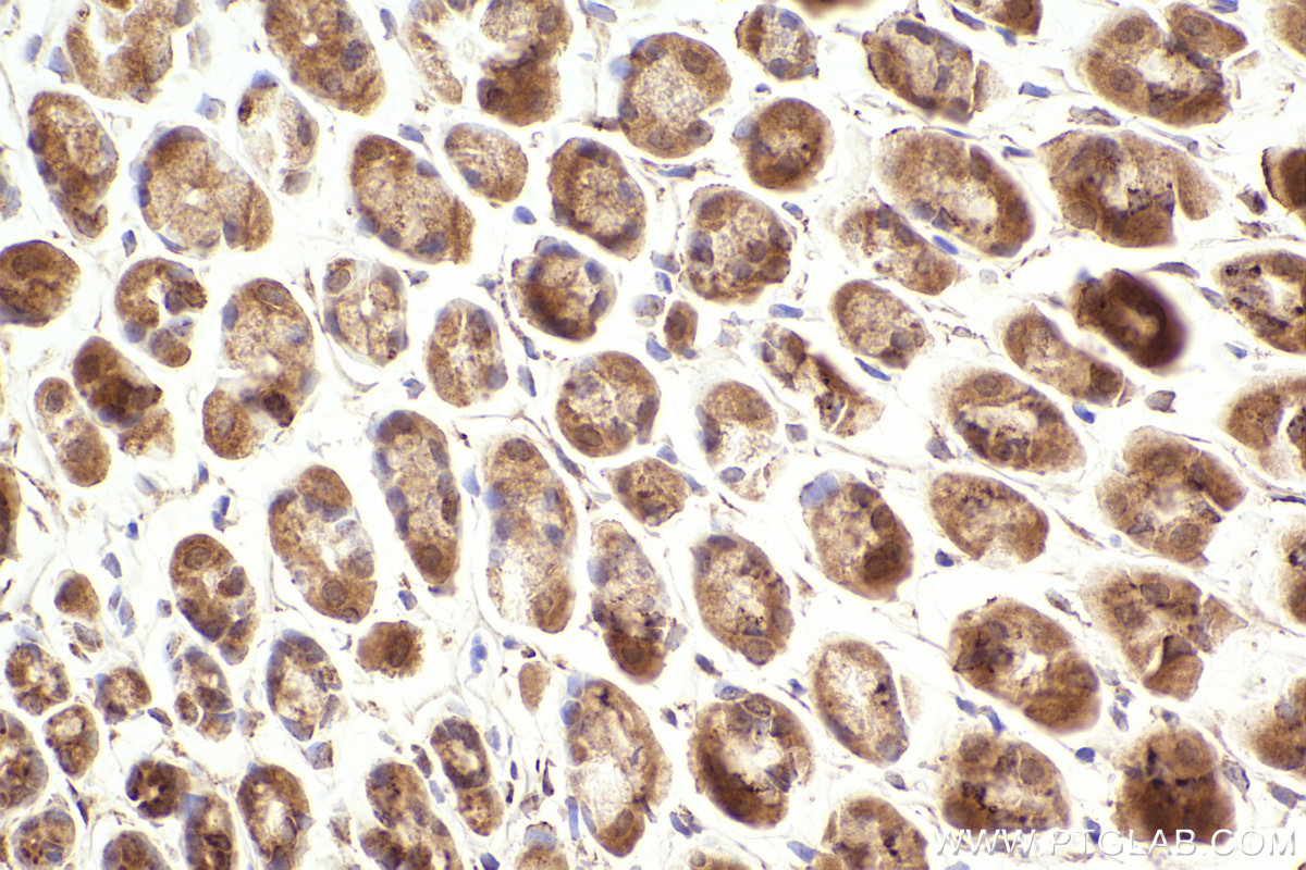 Immunohistochemical analysis of paraffin-embedded mouse stomach tissue slide using KHC2464 (MELK IHC Kit).