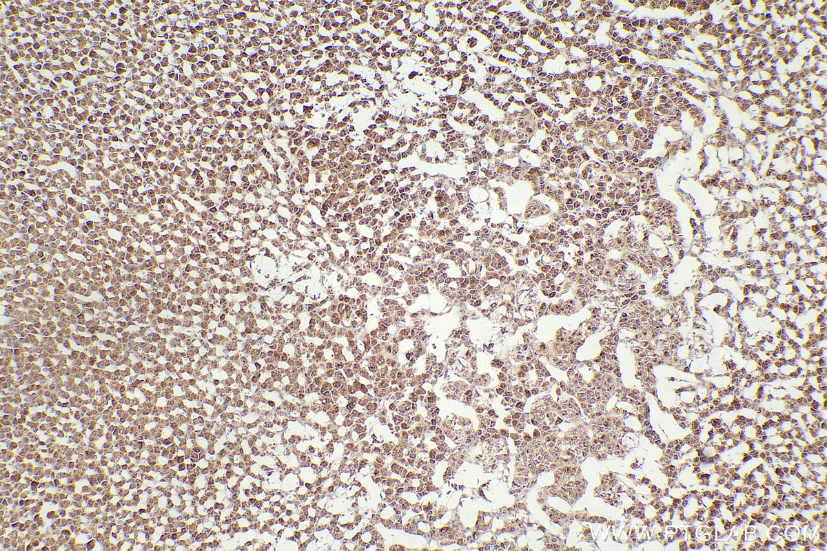 Immunohistochemical analysis of paraffin-embedded rat adrenal gland tissue slide using KHC2464 (MELK IHC Kit).