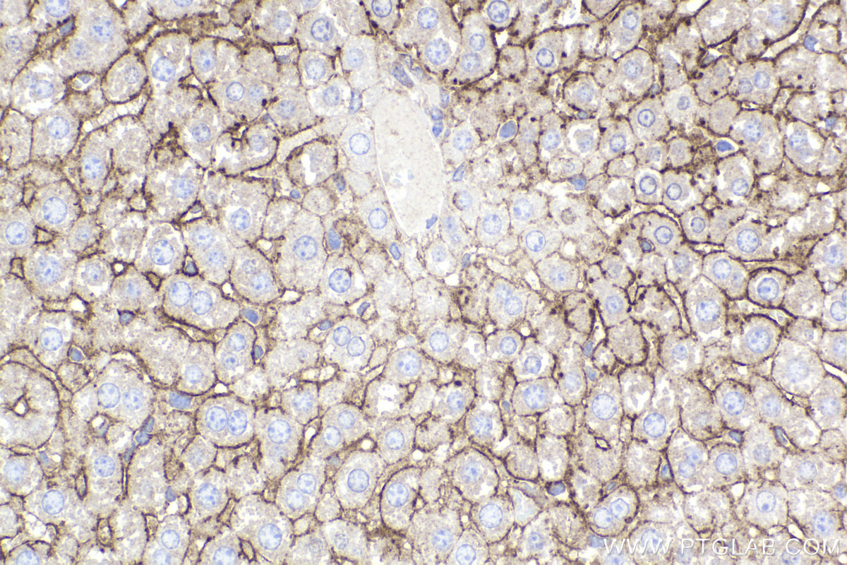 Immunohistochemical analysis of paraffin-embedded mouse liver tissue slide using KHC2170 (MET IHC Kit).
