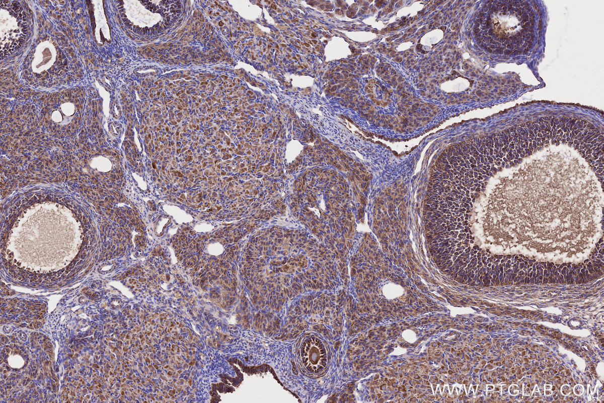 Immunohistochemical analysis of paraffin-embedded rat ovary tissue slide using KHC2650 (MFN1 IHC Kit).