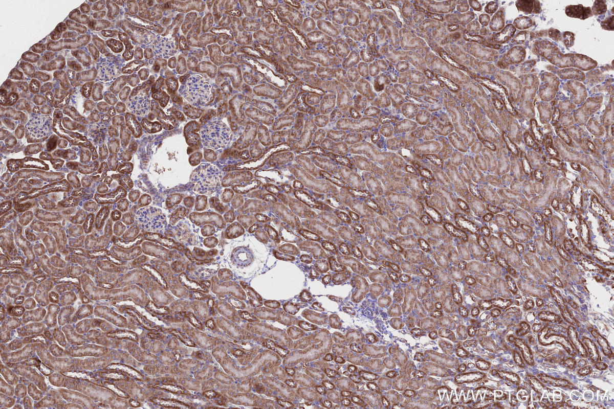 Immunohistochemical analysis of paraffin-embedded mouse kidney tissue slide using KHC2650 (MFN1 IHC Kit).