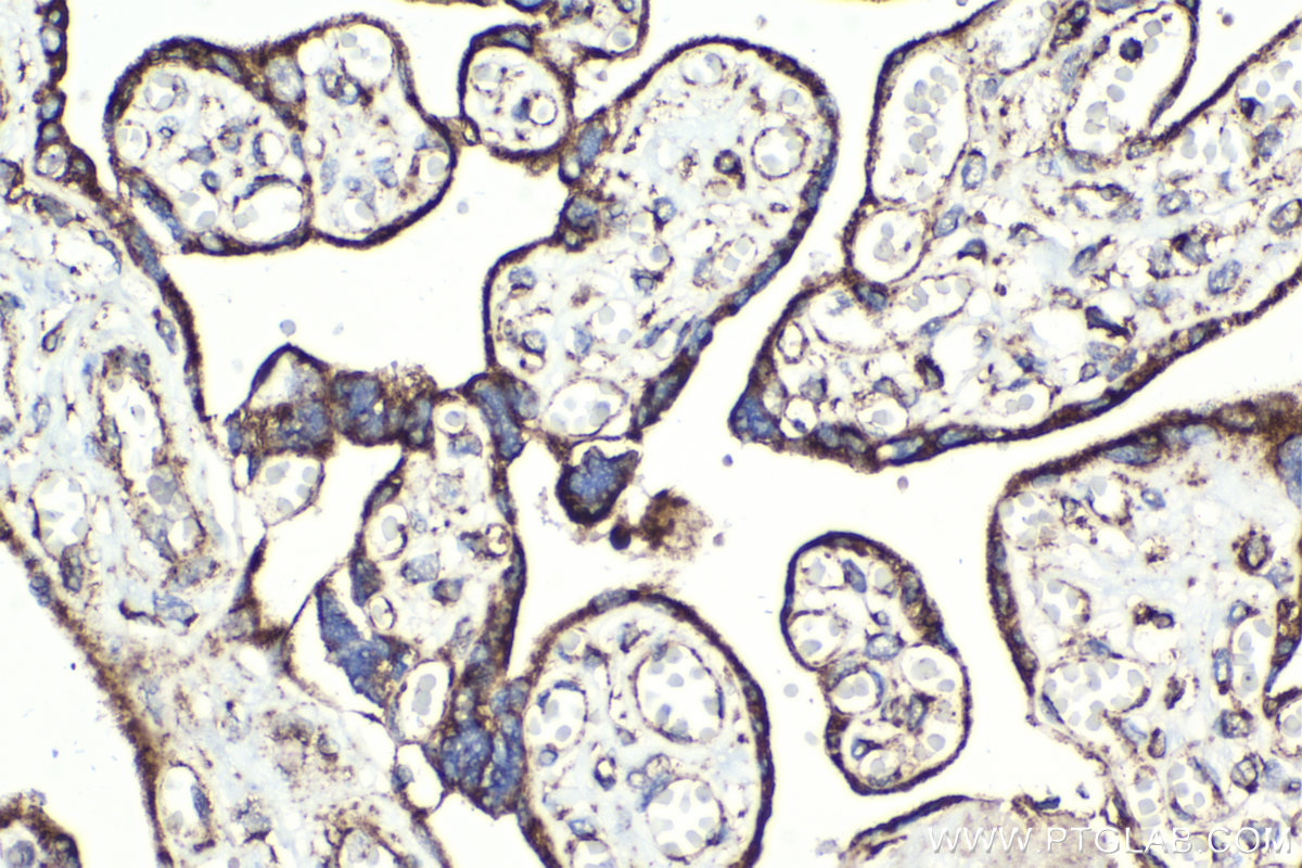 Immunohistochemical analysis of paraffin-embedded human placenta tissue slide using KHC2133 (MFN2 IHC Kit).