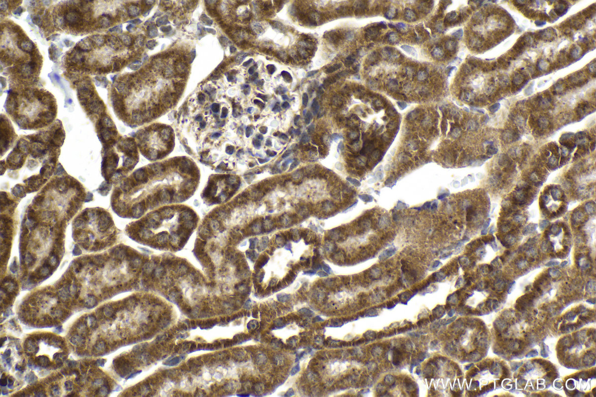 Immunohistochemical analysis of paraffin-embedded mouse kidney tissue slide using KHC2133 (MFN2 IHC Kit).