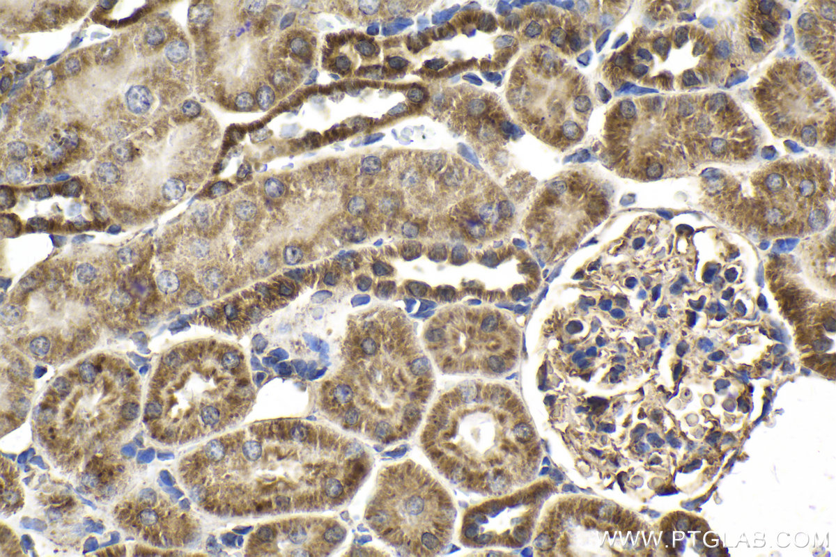 Immunohistochemical analysis of paraffin-embedded rat kidney tissue slide using KHC2133 (MFN2 IHC Kit).